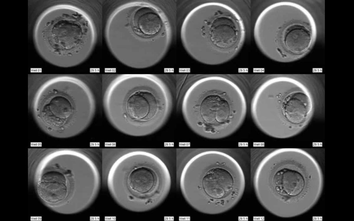 Tecnología time-lapse en la fecundación in vitro. ¿En qué consiste?